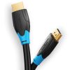 Vention HDMI Cable 15M Black – AACBN